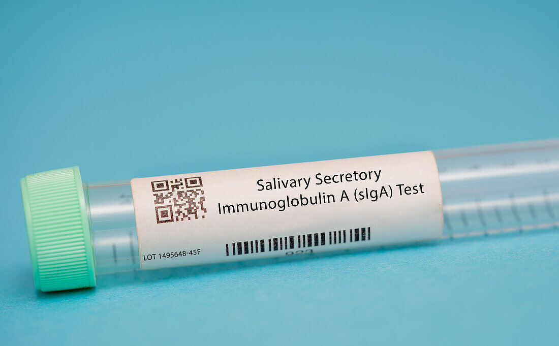 Salivary secretory immunoglobulin A test