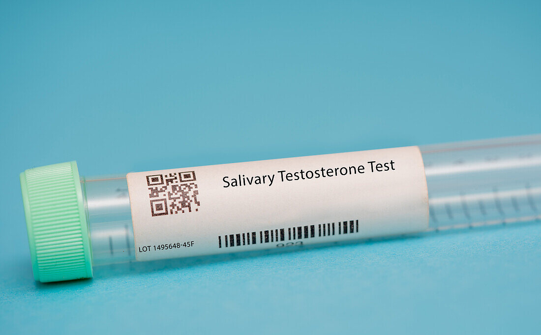 Salivary testosterone test
