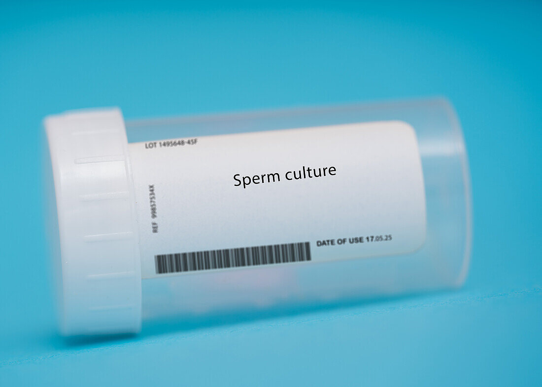 Sperm culture