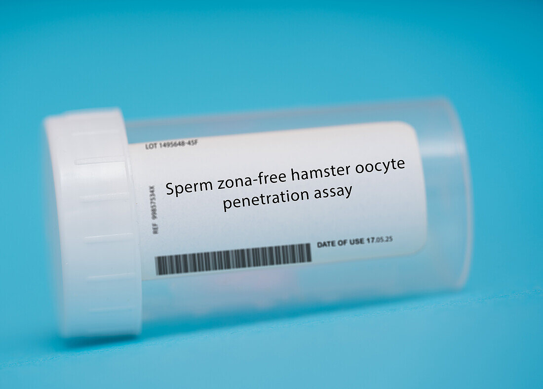 Sperm zona-free hamster oocyte penetration assay