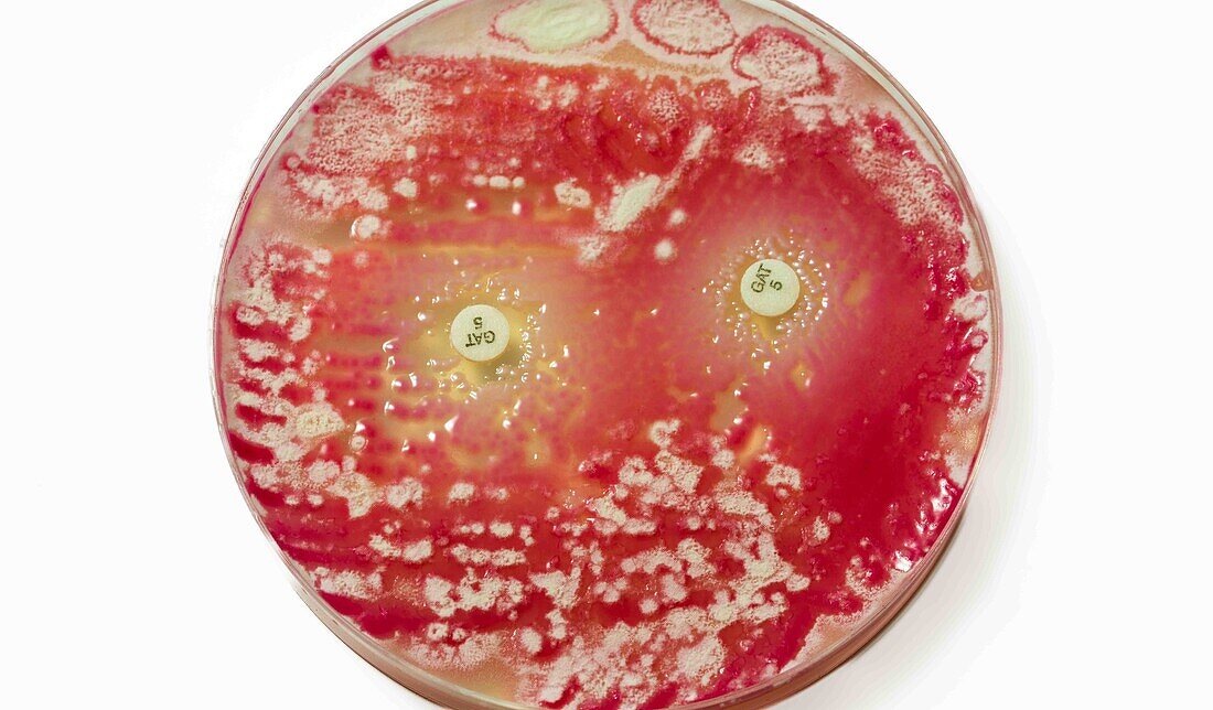 Petri dish with bacterial colony