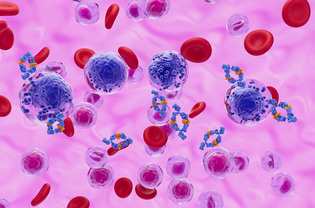Monoclonal antibody treatment of acute myeloid leukaemia, illustration