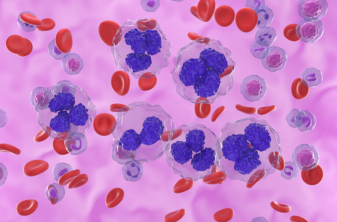 Follicular lymphoma cells, illustration