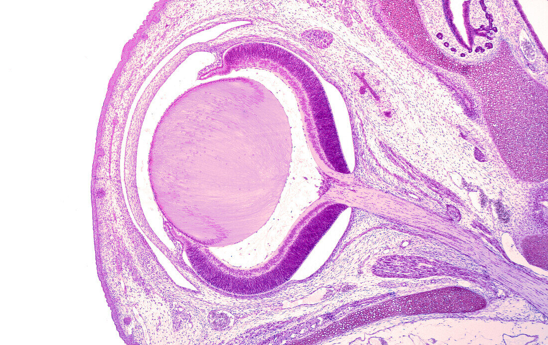 Developing rat eye, light micrograph