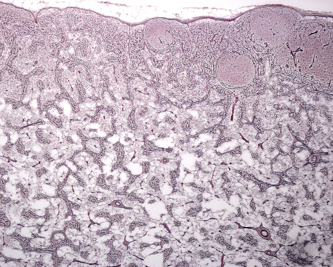 Lymph node reticular fibres, light micrograph