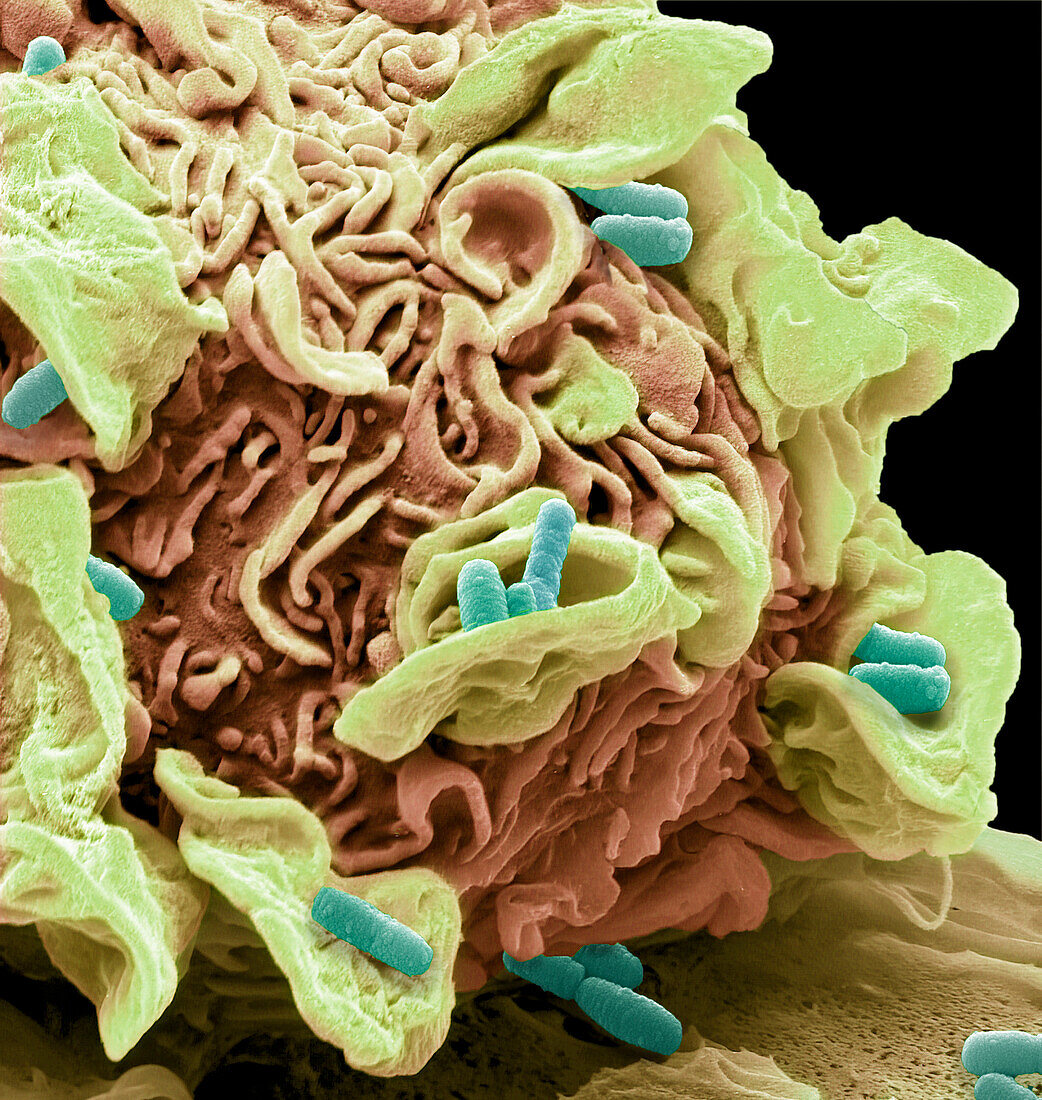 Macrophage engulfing e.coli bacteria, SEM