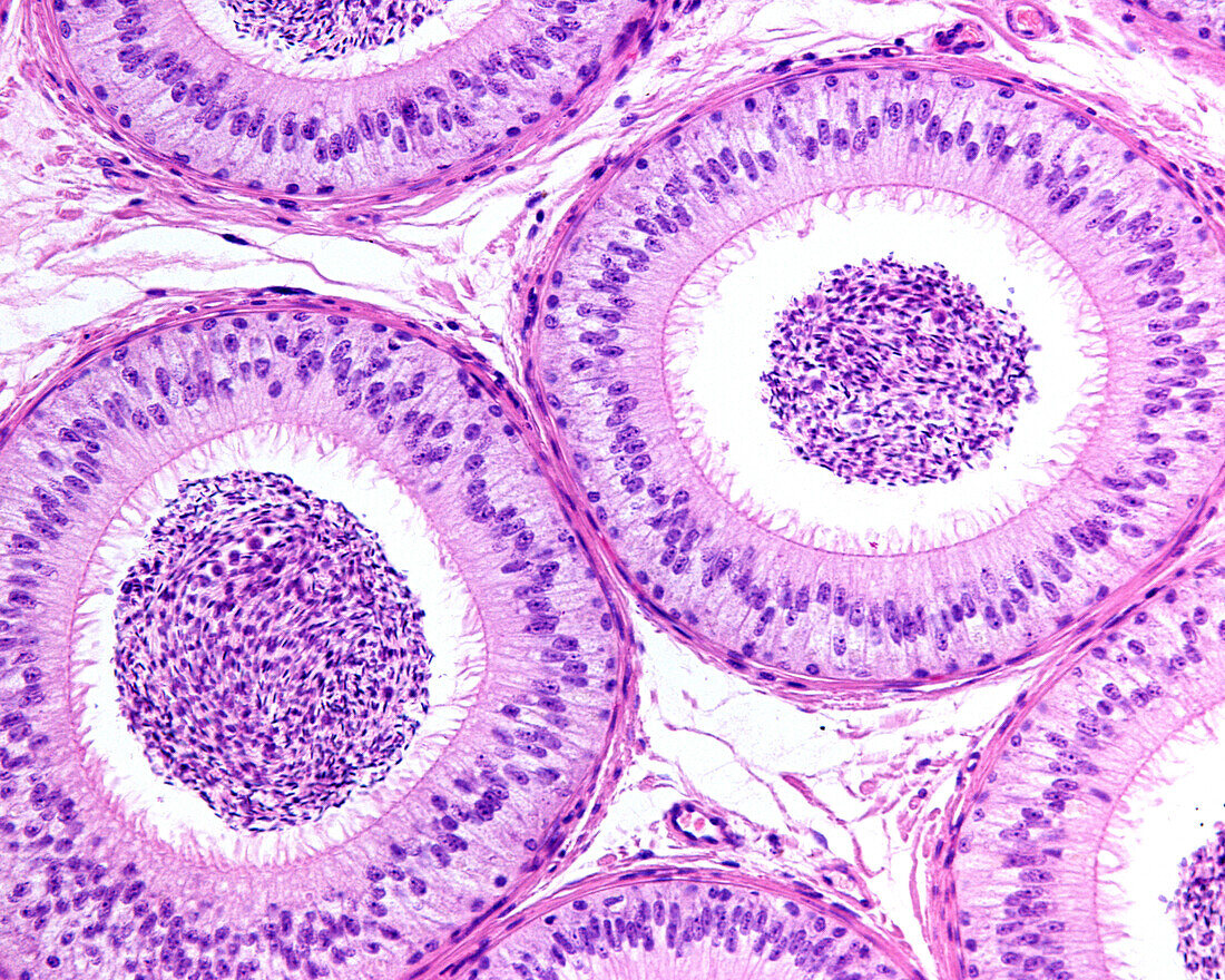 Epididymis pseudostratified epithelium, light micrograph