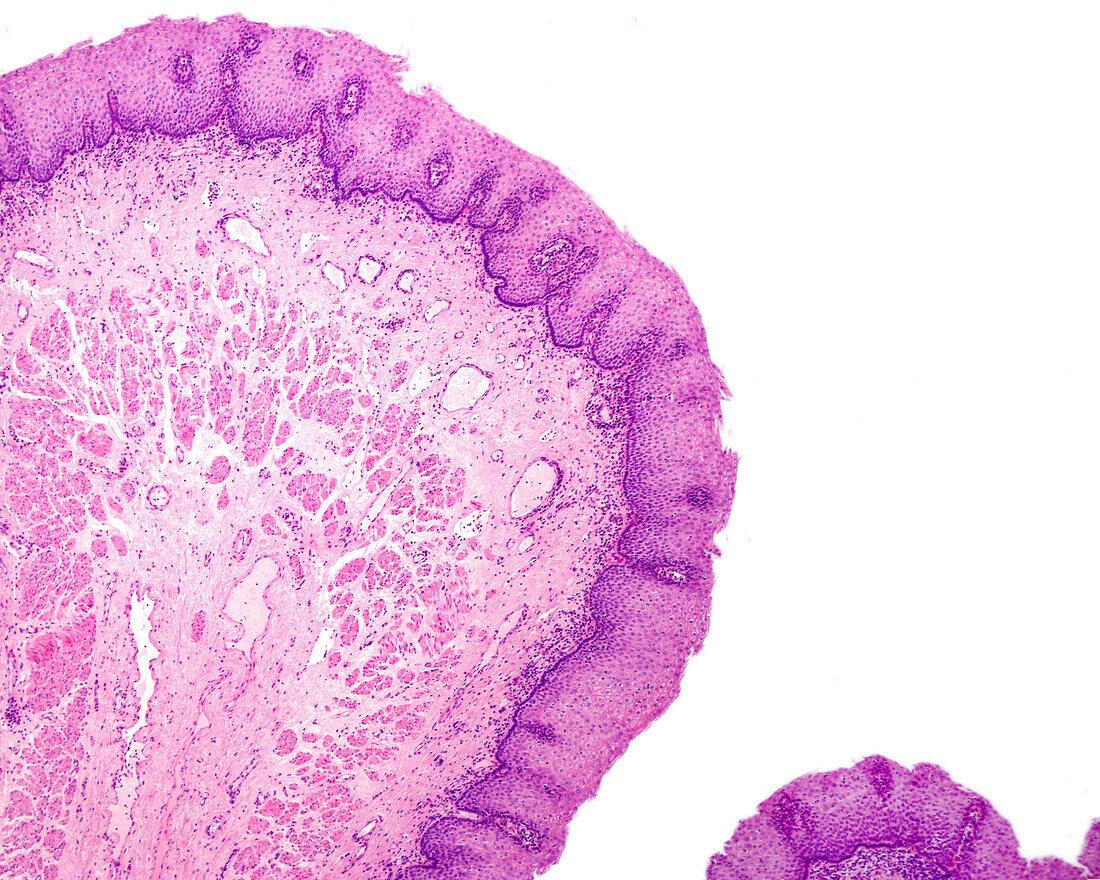 Human oesophagus, light micrograph