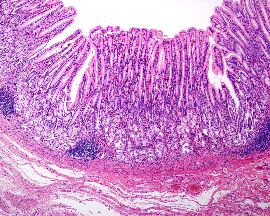 Human gastric mucosa, light micrograph
