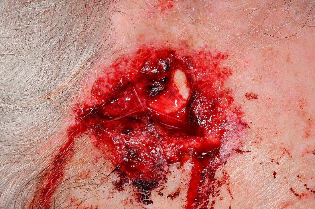 Injury on a man's head