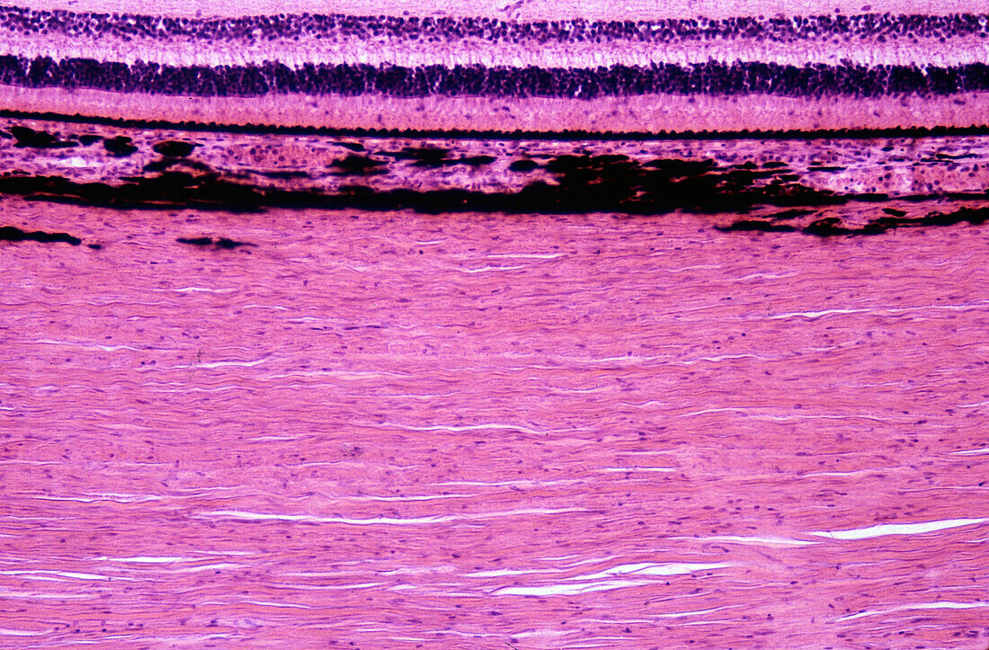 Human eyeball layers, light micrograph