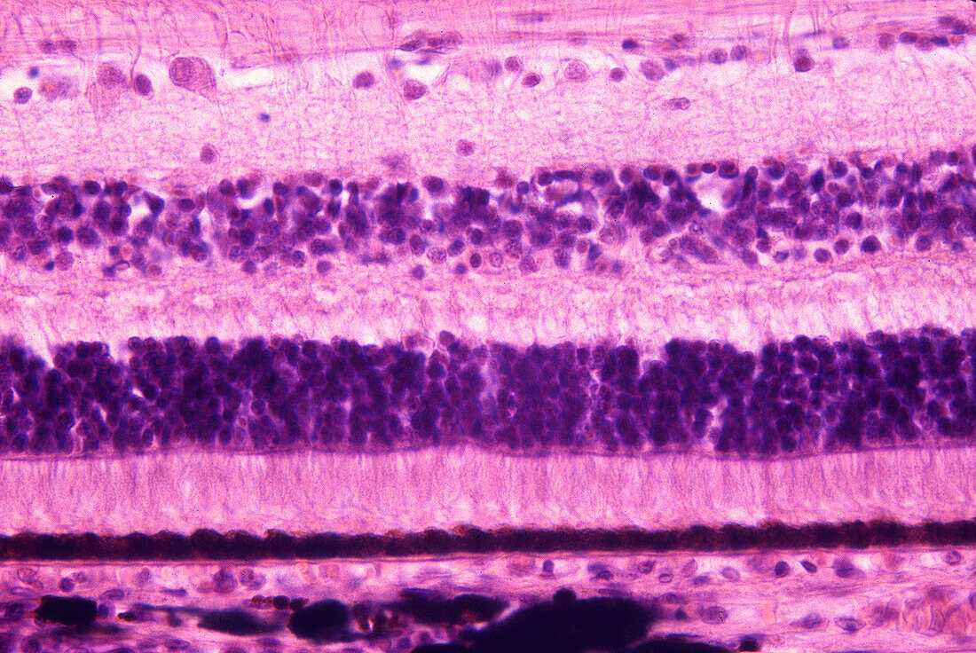 Human retina, light micrograph