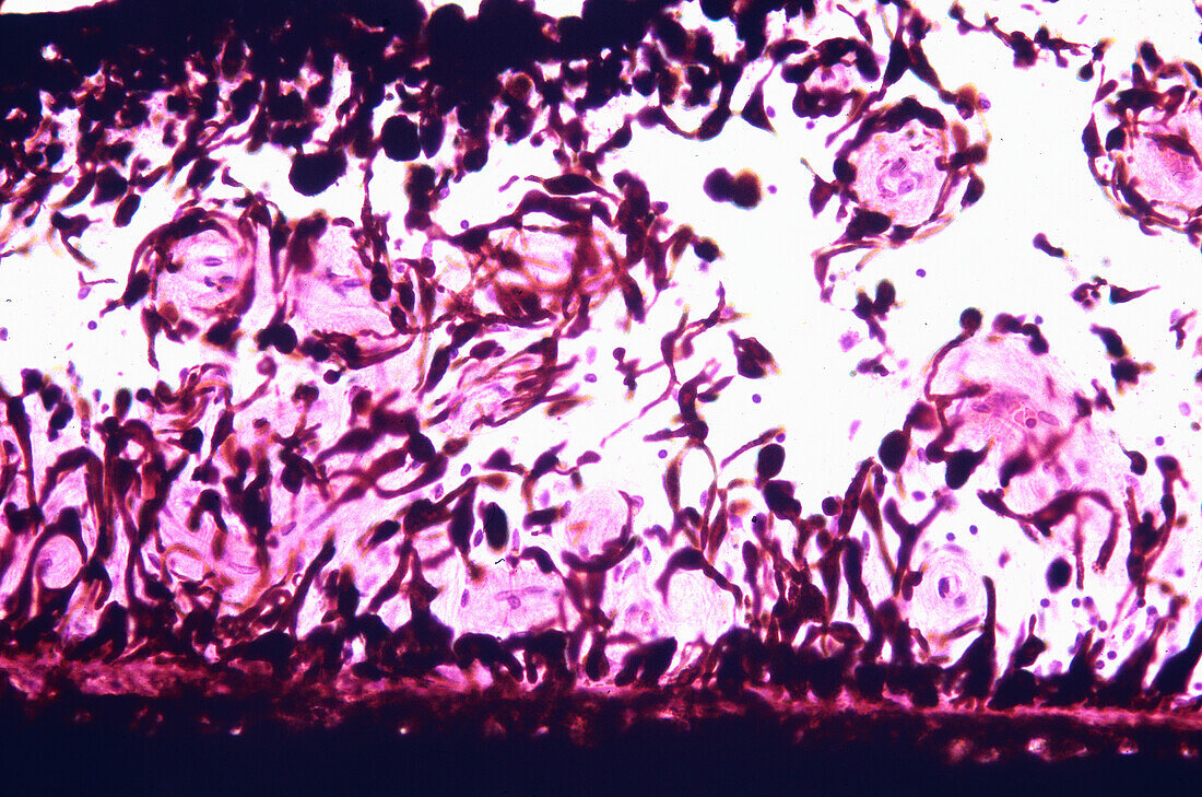 Human Iris, light micrograph