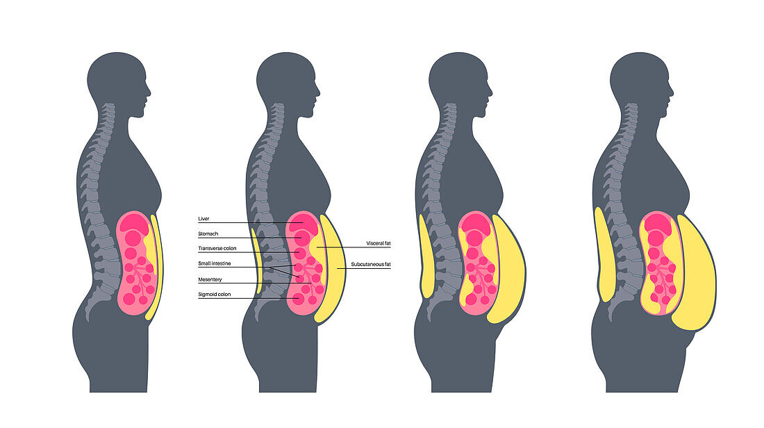 Visceral fat diagram, illustration