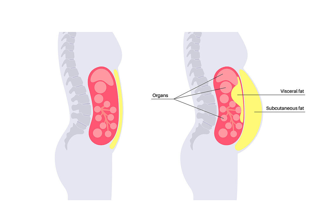 Visceral fat diagram, illustration