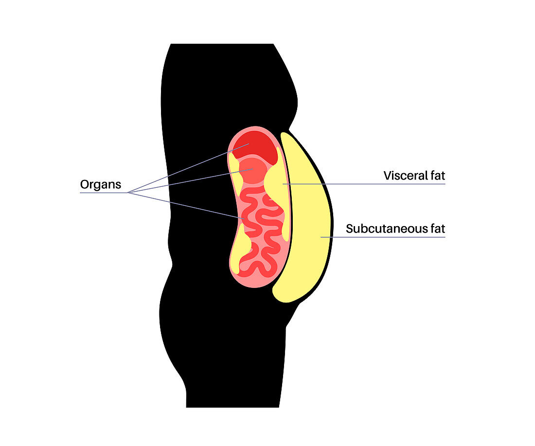 Visceral fat diagram, illustration