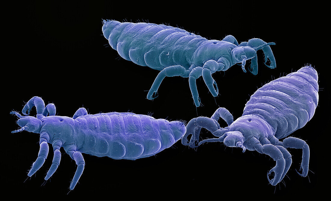 Head lice, SEM