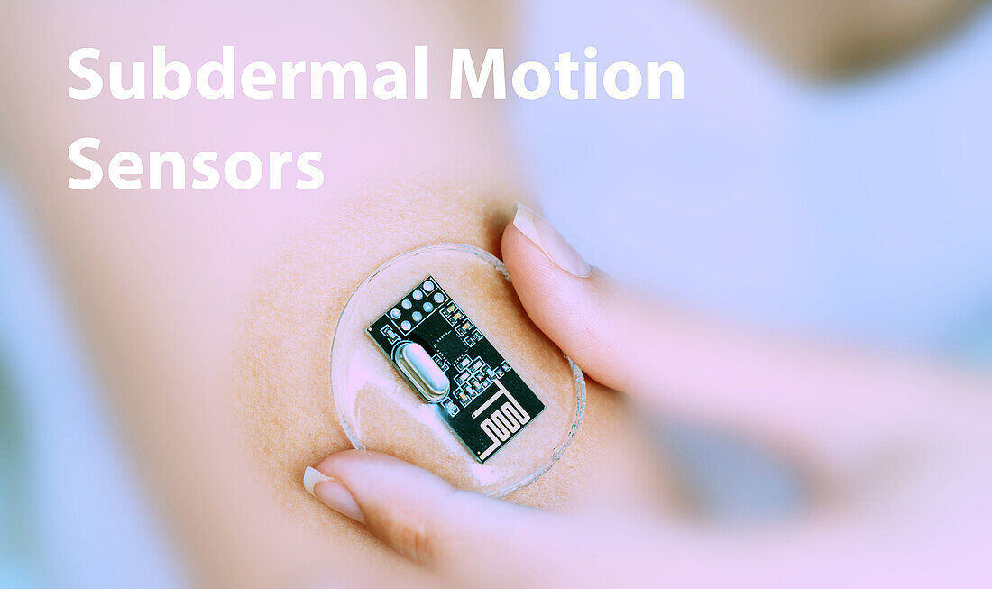 Subdermal motion sensors, conceptual image