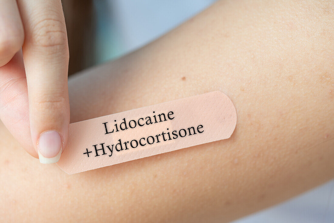 Lidocaine and hydrocortisone dermal patch, conceptual image