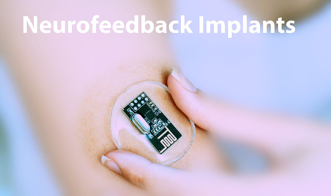 Neurofeedback implantable device, conceptual image