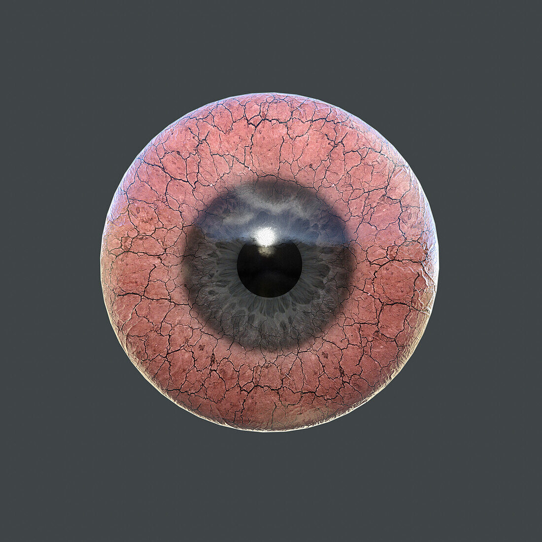 Dry eye, conceptual illustration