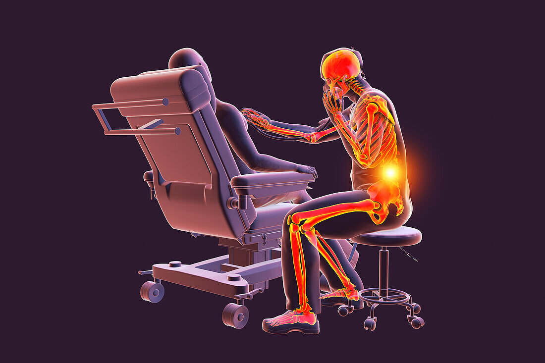 Healthcare worker experiencing back pain, illustration