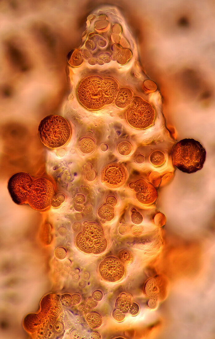 Das Bild zeigt kristallisierte Sojasauce, fotografiert durch das Mikroskop im Hellfeld bei einer Vergrößerung von 100X