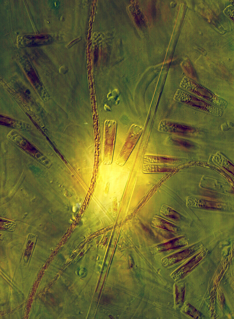 Das Bild zeigt Kieselalgen (hauptsächlich Gomphonema sp.), die durch das Mikroskop in polarisiertem Licht bei einer 200-fachen Vergrößerung fotografiert wurden.