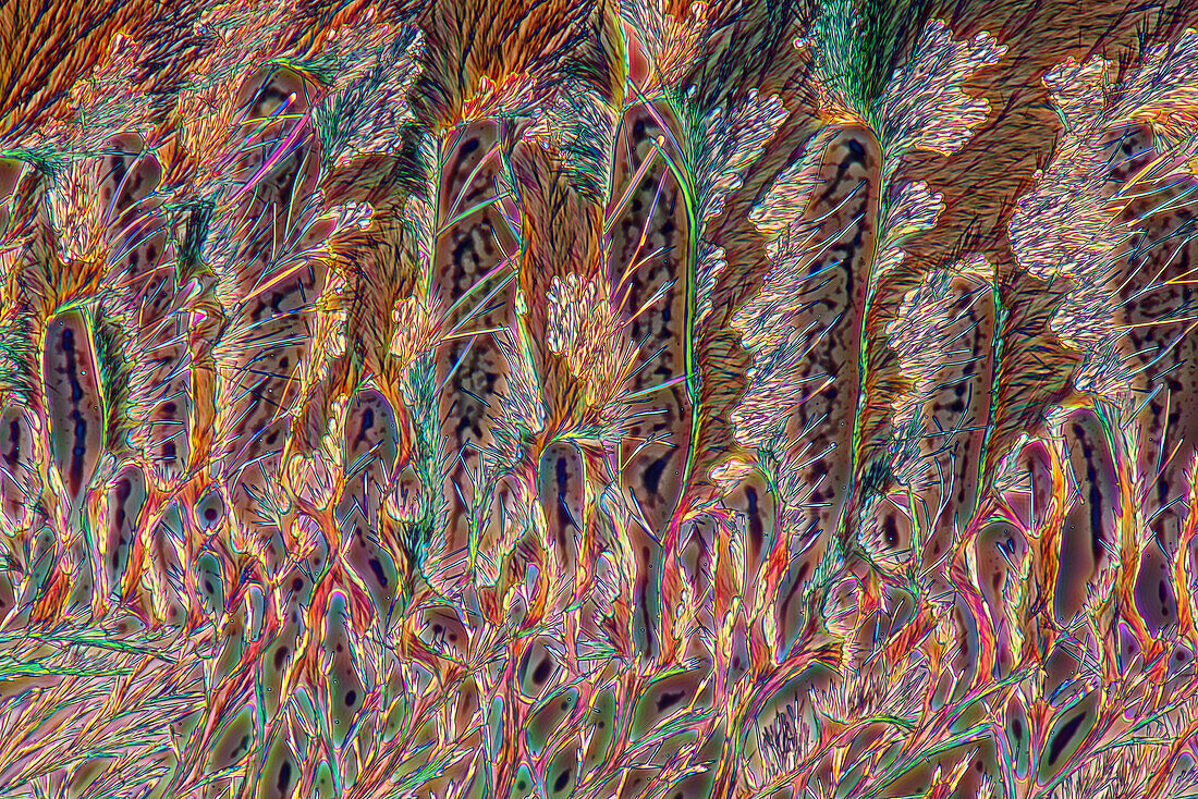 The image presents crystallized callus remover, photographed through the microscope in polarized light at a magnification of 100X\n