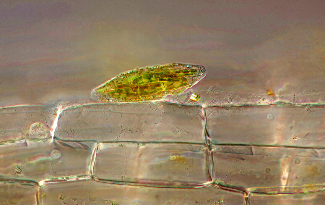 The image presents diatoms closed in a special kind of the protecting case, photographed through the microscope in polarized light at a magnification of 400X\n