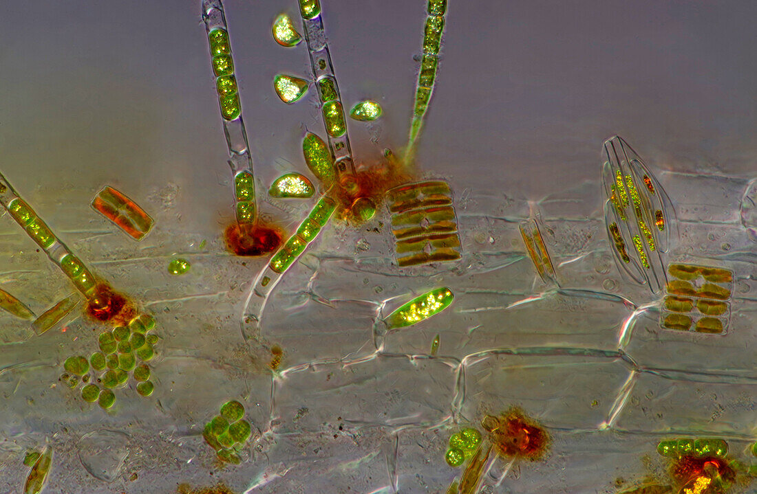 The image presents various tiny algae settled on Lemna sp. root, photographed through the microscope in polarized light at a magnification of 200X\n