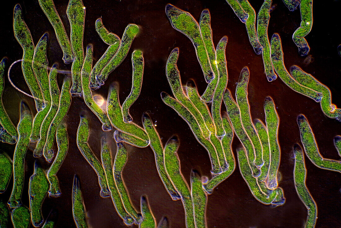 Das Bild zeigt Ophrydium sp. (eine Art kolonialer Wimpertierchen), fotografiert durch das Mikroskop in polarisiertem Licht und Dunkelfeld bei einer Vergrößerung von 100X