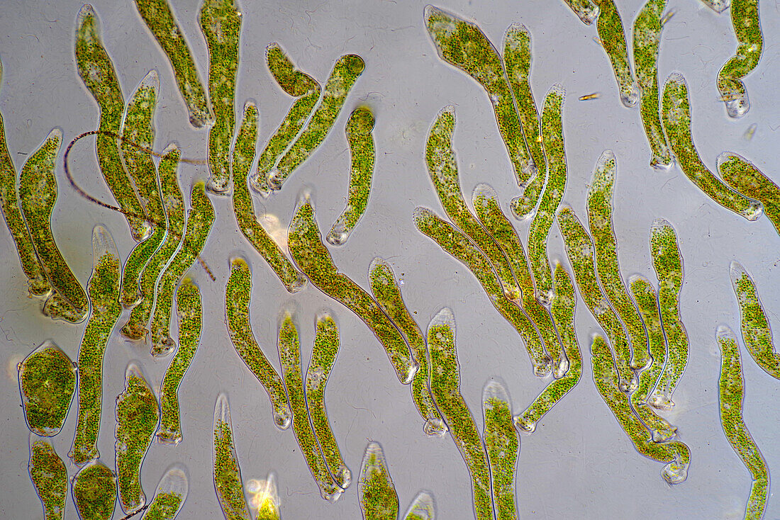Das Bild zeigt Ophrydium sp. (eine Art kolonialer Wimpertierchen), fotografiert durch das Mikroskop in polarisiertem Licht bei einer Vergrößerung von 100X