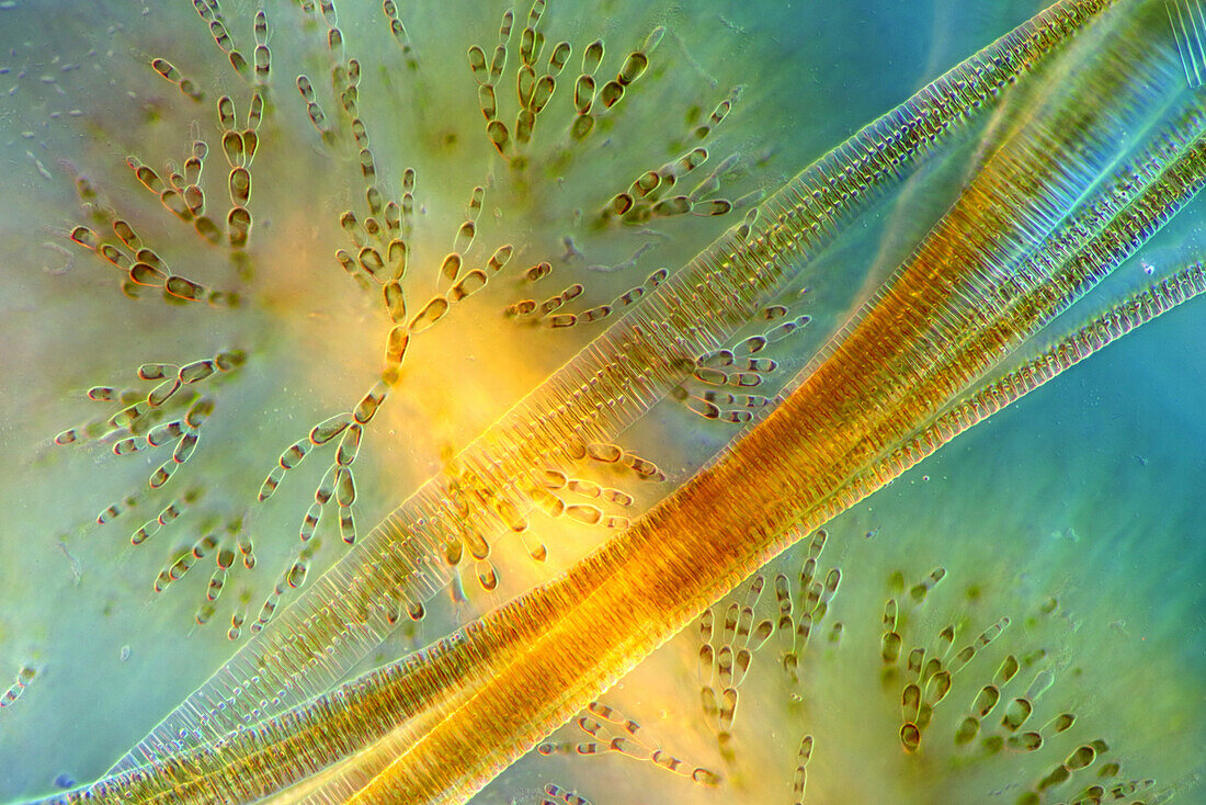 The image presents Fragilaria sp., a kind of diatoms against Batrachospermum, a kind of red algae, photographed through the microscope in polarized light at a magnification of 200X\n