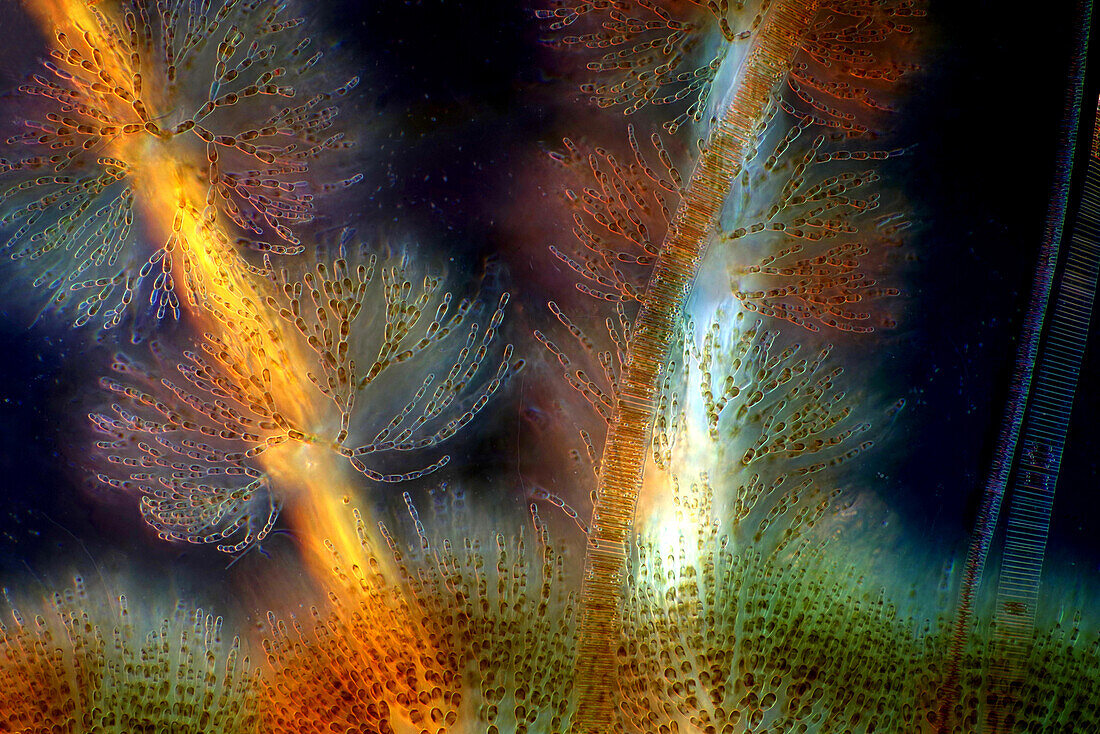 The image presents Batrachospermum sp., a kind of red algae, and FRagilaria sp., a kind of diatoms, photographed through the microscope in polarized light and dark field at a magnification of 100X\n