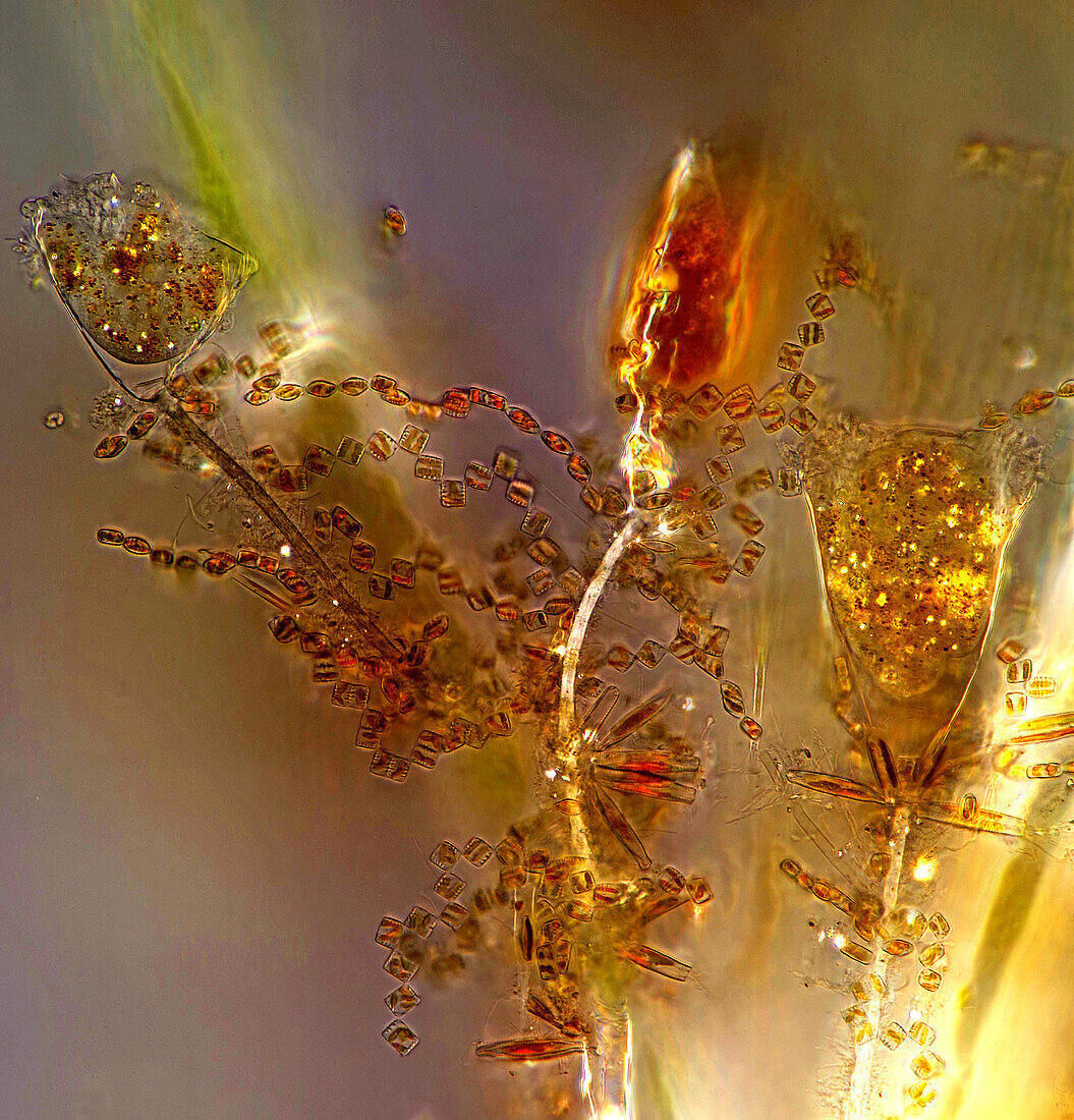 The image presentstwo suctorians ( a kind of ciliate) and tiny diatoms, photographed through the microscope in polarized light at a magnification of 200X\n