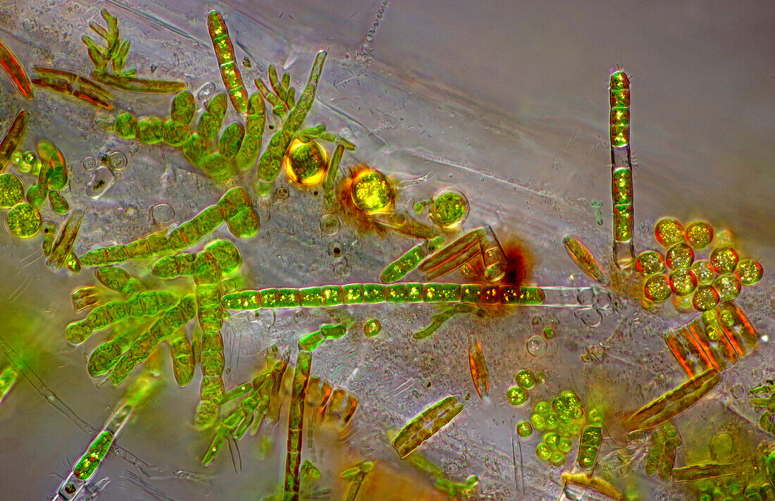 Das Bild zeigt verschiedene winzige Algen, die sich auf der Wurzel von Lemna sp. angesiedelt haben, fotografiert durch das Mikroskop in polarisiertem Licht bei einer Vergrößerung von 200X