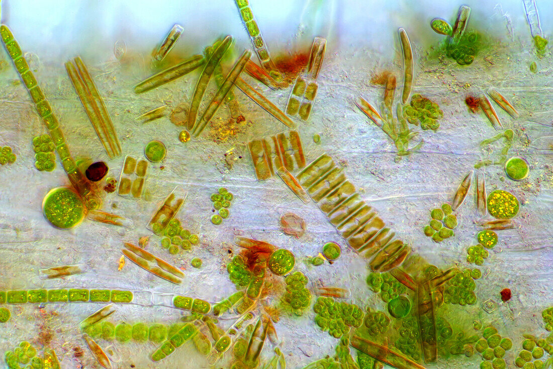 The image presents various tiny algae settled on Lemna sp. root, photographed through the microscope in polarized light at a magnification of 200X\n