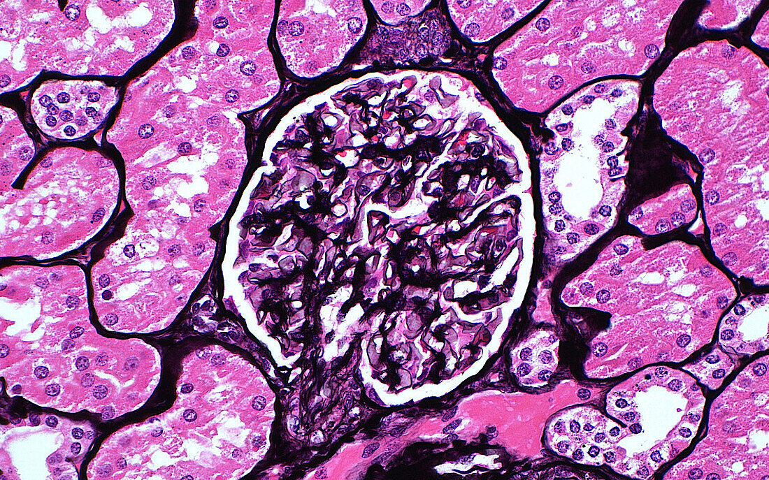 Glomerulus, light micrograph