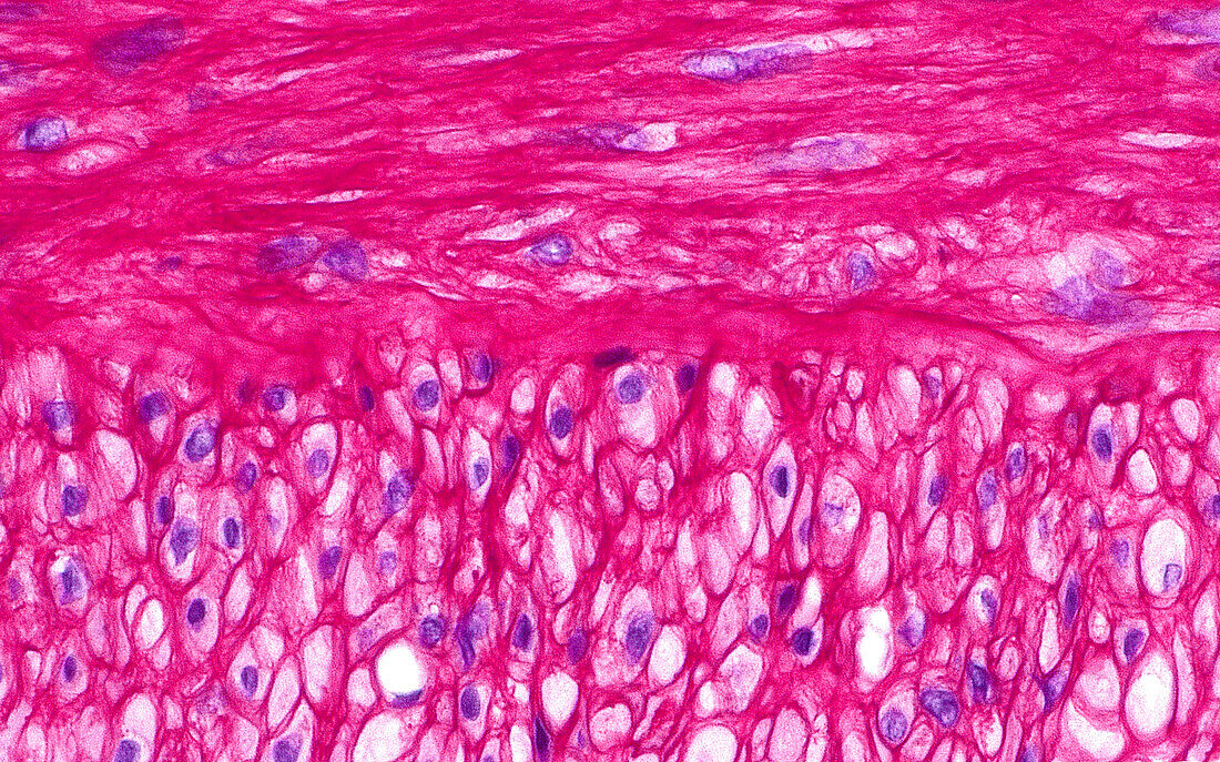 Intima and media of kidney blood vessel, light micrograph