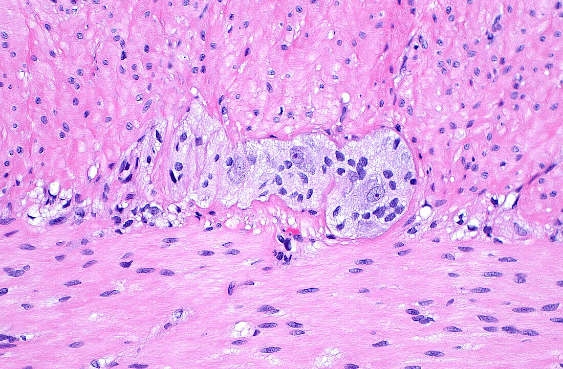 Myenteric nerve plexus cells, light micrograph