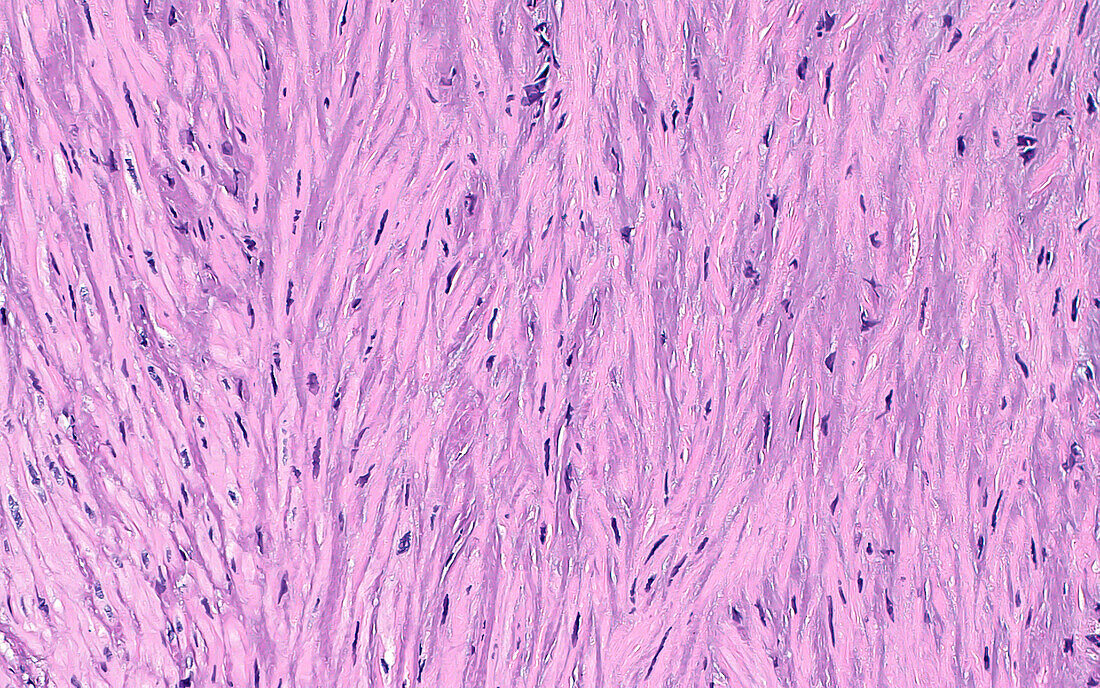 Smooth muscle in prostate, light micrograph