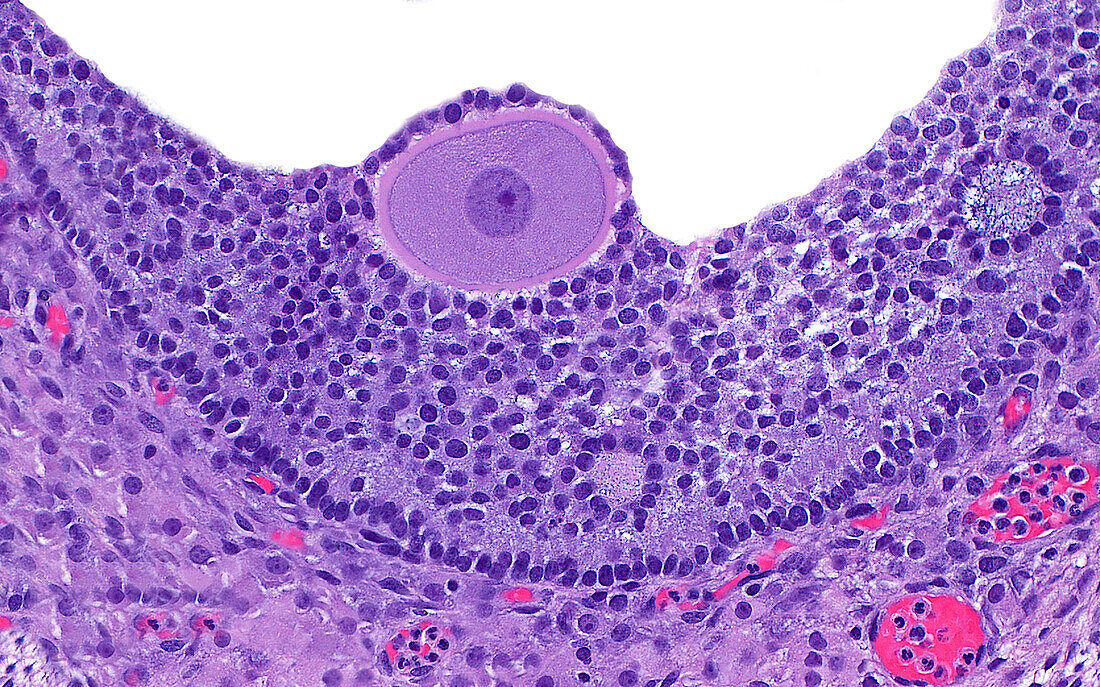 Tertiary ovarian follicle, light micrograph