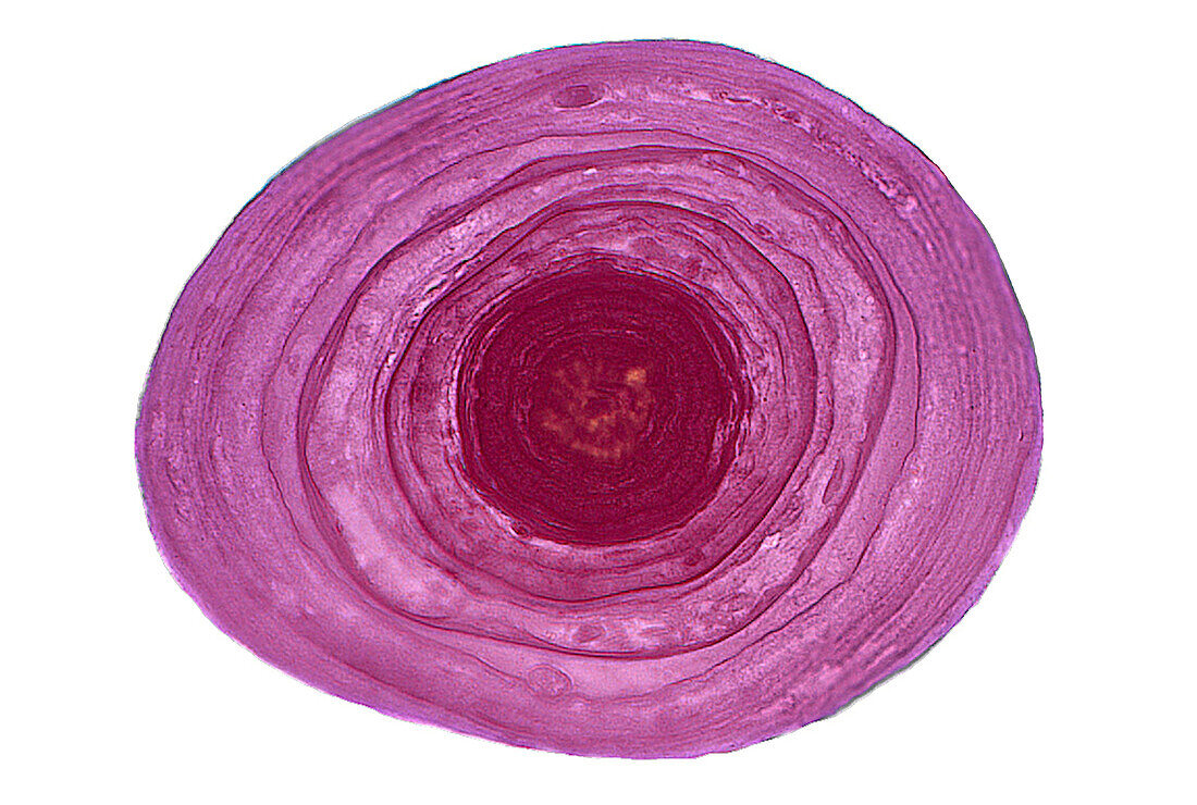 Corpus amylaceous, light micrograph