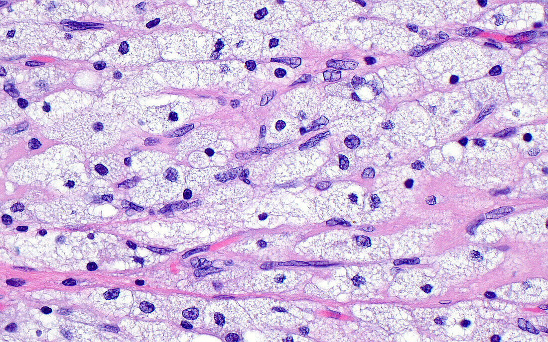 Corpus luteum cells, light micrograph