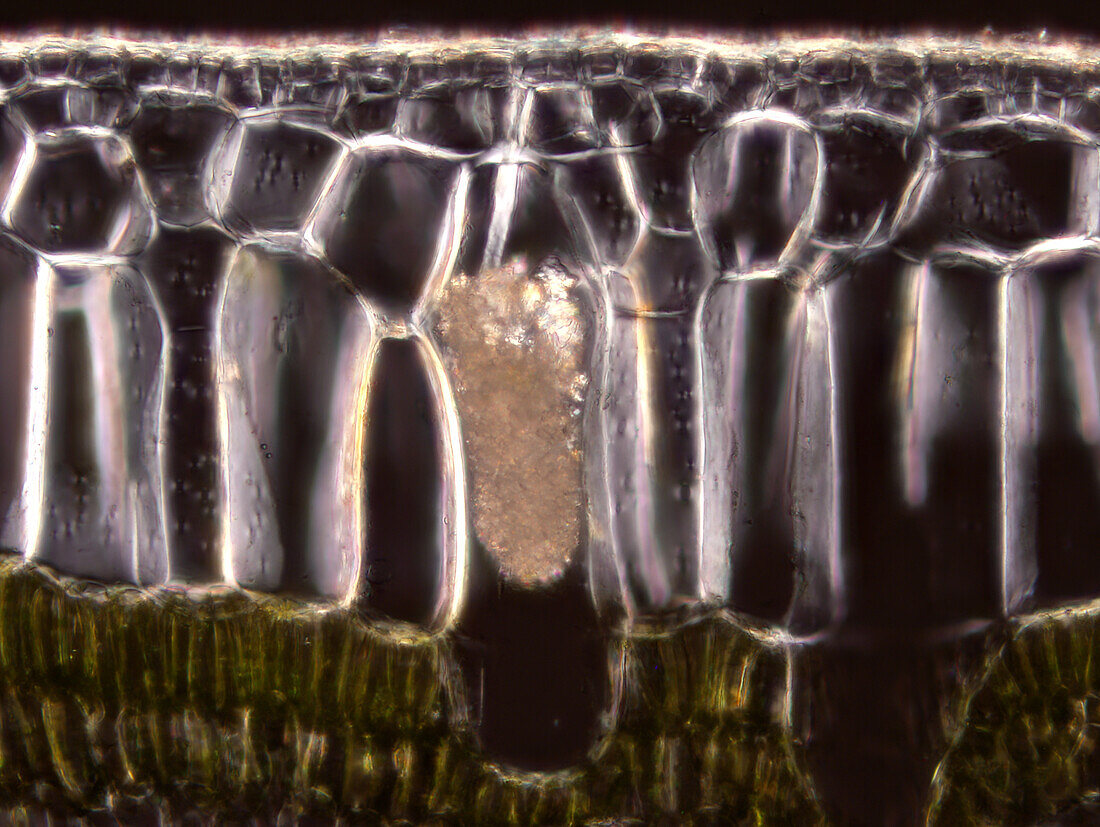 Rubber fig leaf, light micrograph