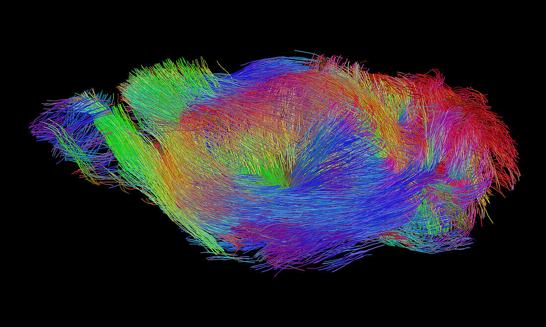 Mouse white matter fibres, DTI MRI scan