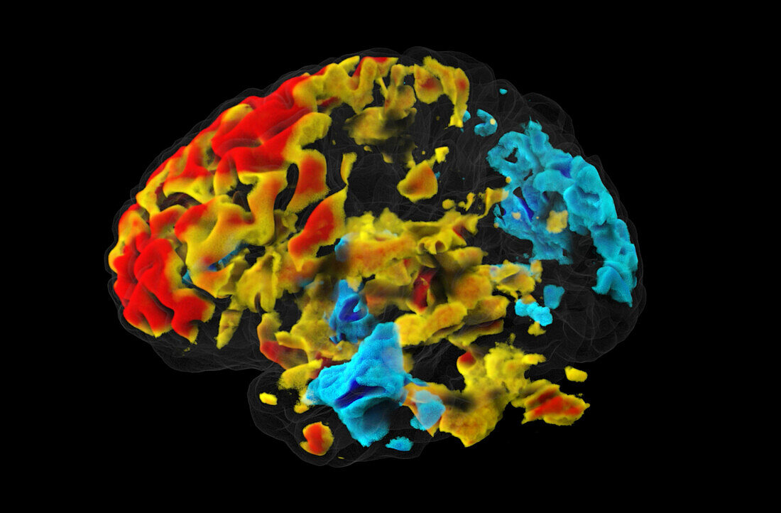 Resting brain, fMRI scan