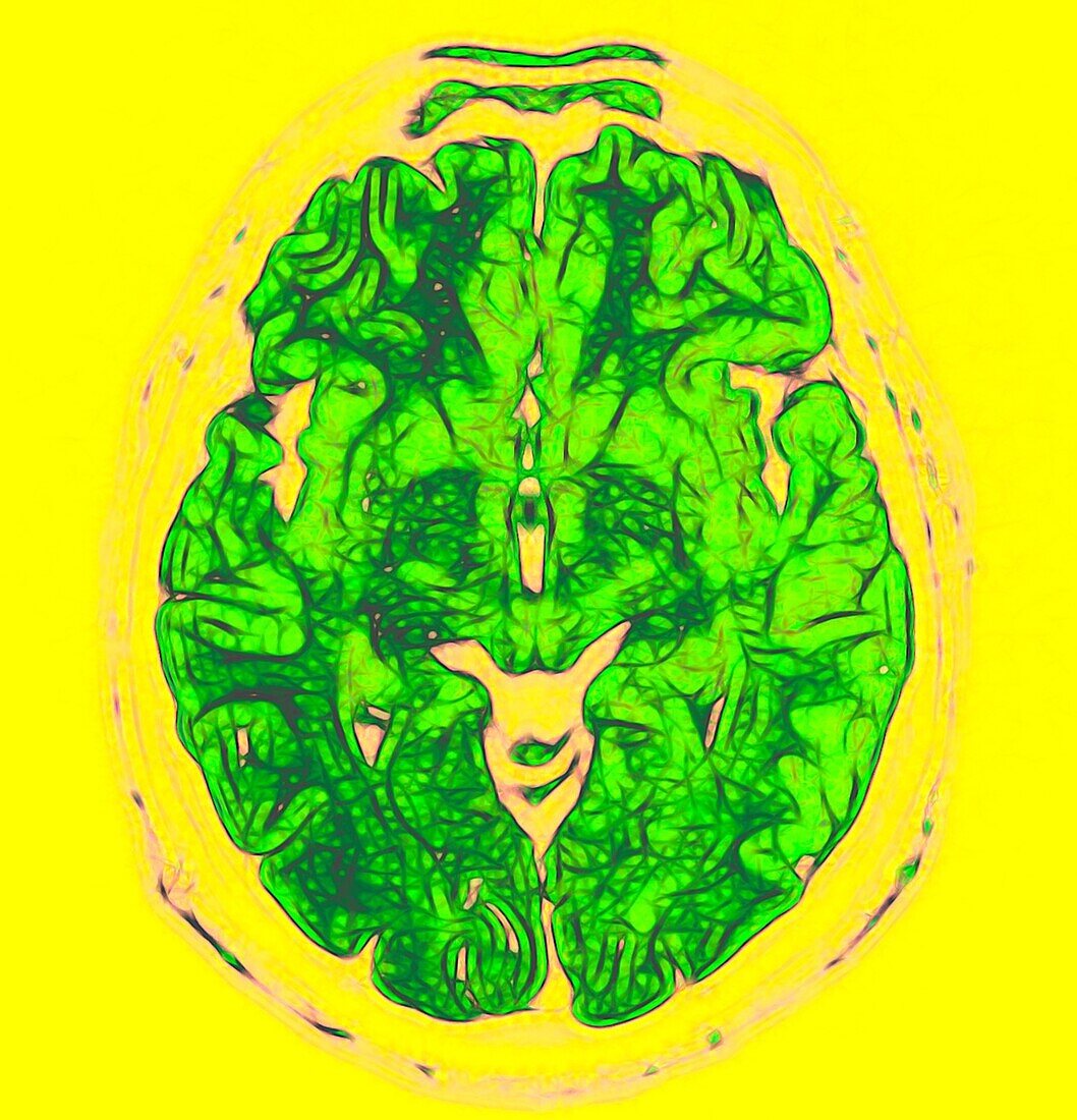 Human brain, MRI scan