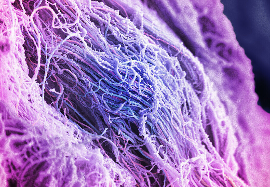 Human connective tissue, SEM